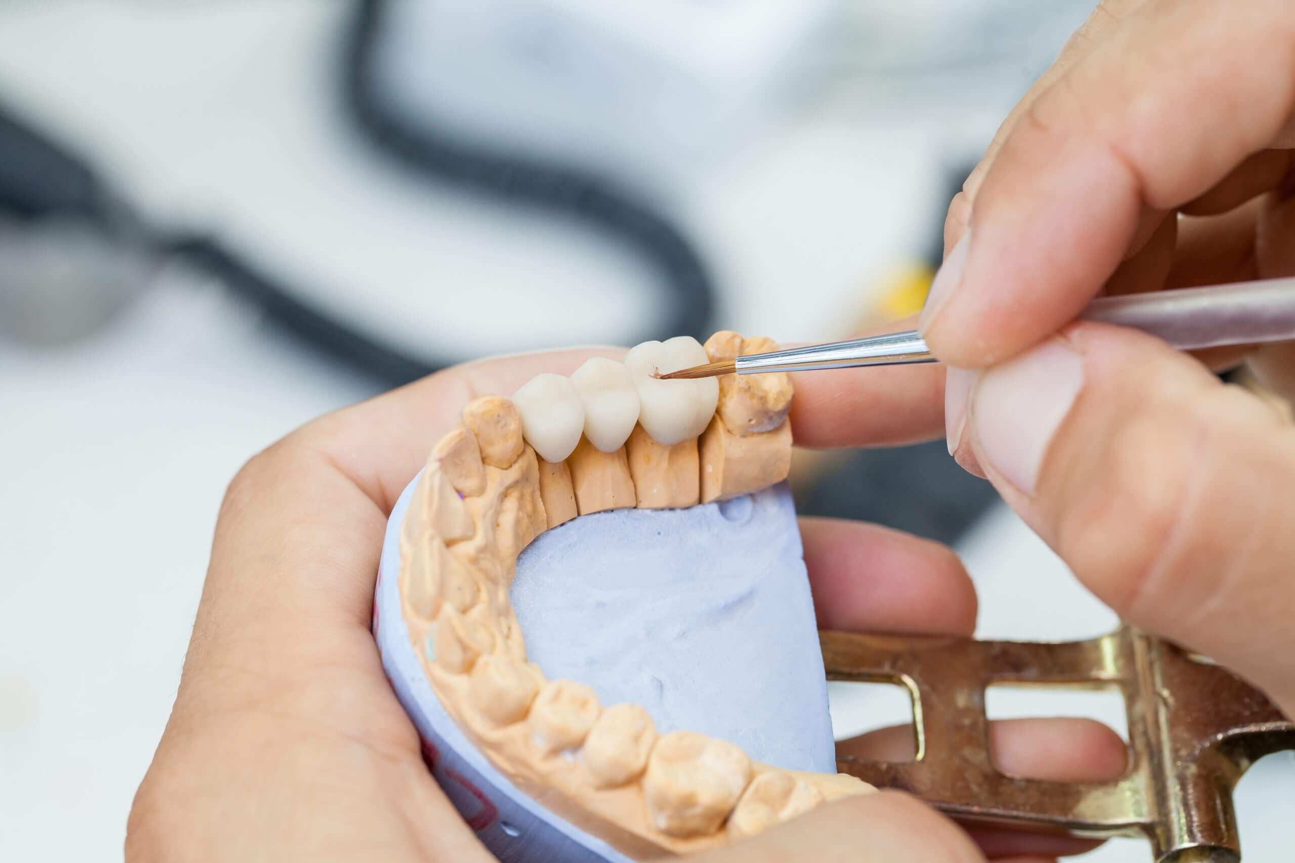 dental technician works by brush with jaw model