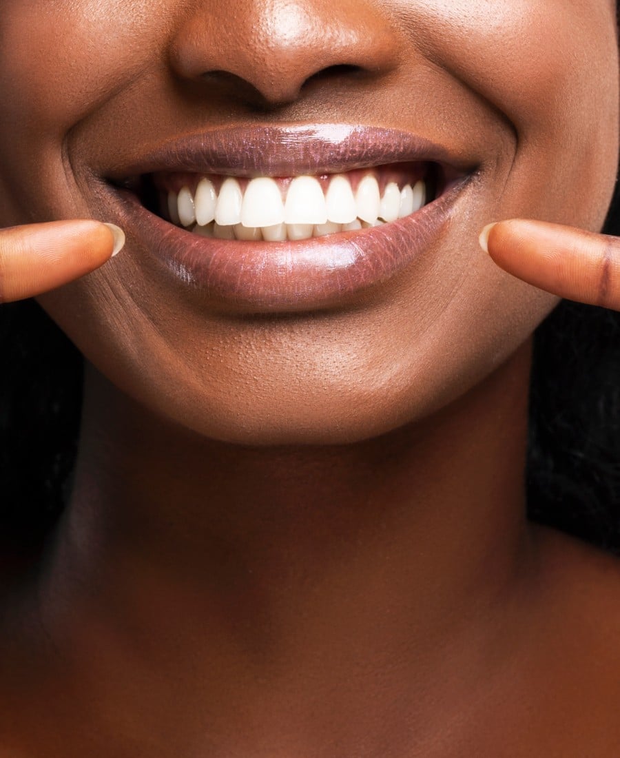FAQ- teeth-whitening