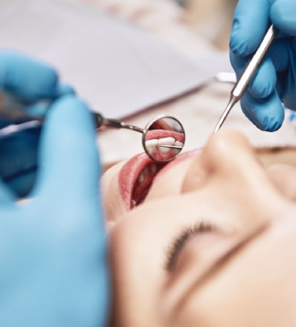 When Should I Get An Oral Cancer Exam
